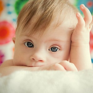 Baby with Down's Syndrome