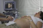 Woman getting a pregnancy ultrasound